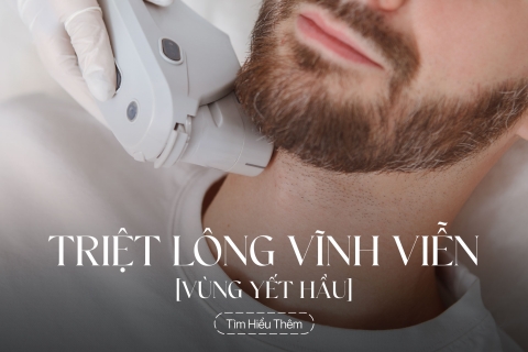 Triệt lông vùng yết hầu vĩnh viễn